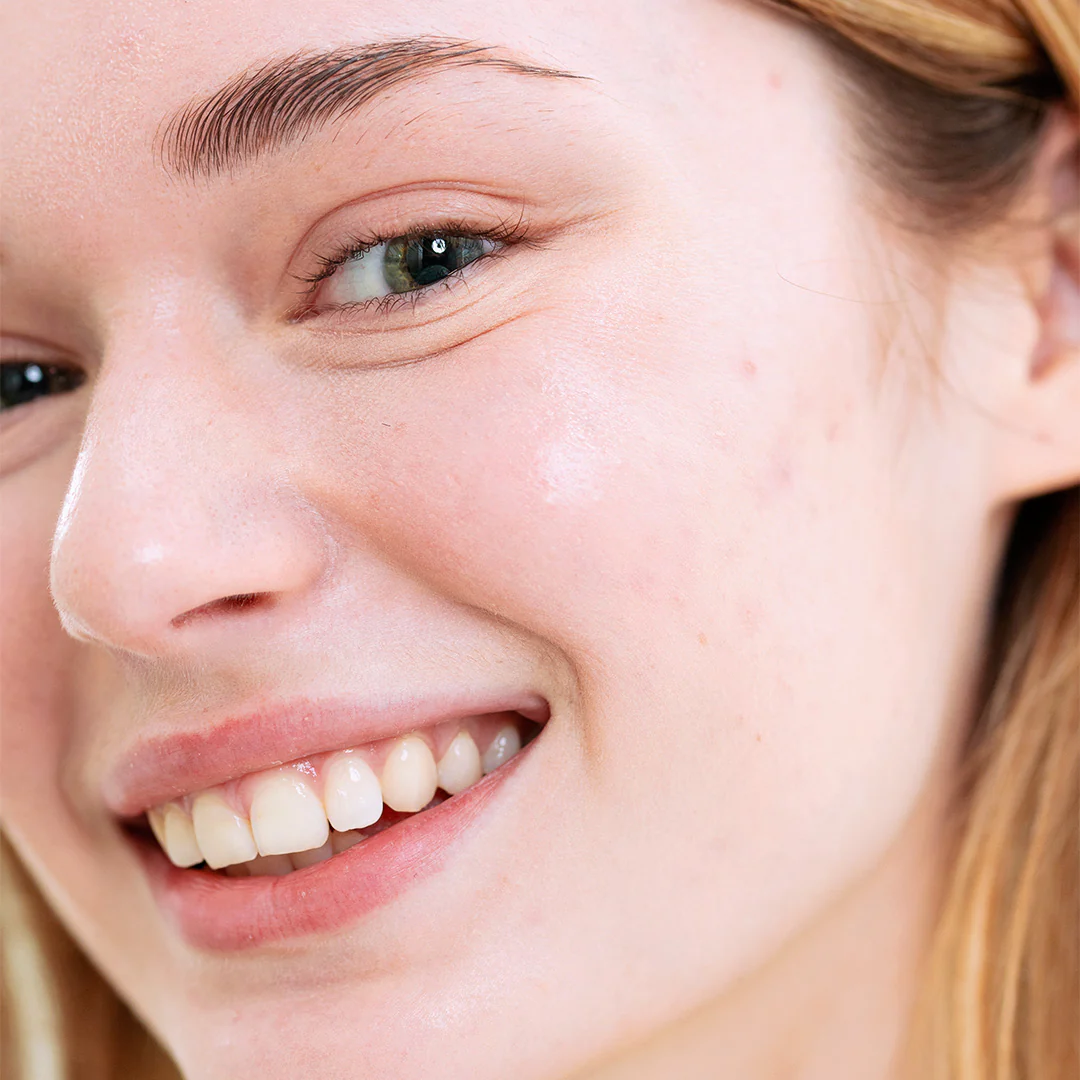 Routine Anti-Imperfections Sebiaclear - Image 5